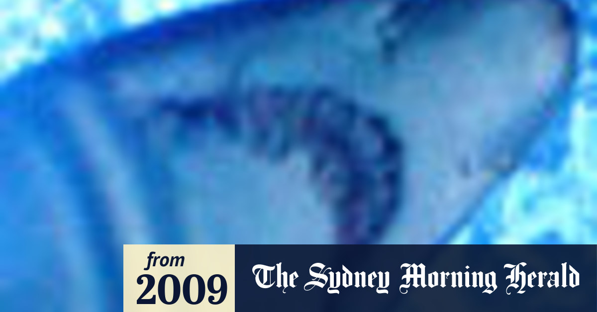 Man attacked by shark in Sydney Harbour